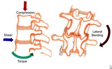 The various forces placed on the disks of the lumb