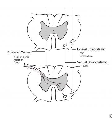 Simplified representation of course of major senso