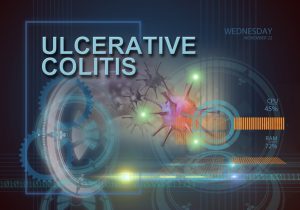 ulcerative colitis complications
