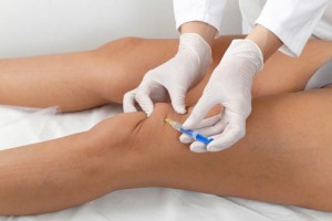 A new treatment for knee arthritis