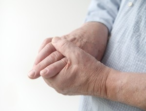 Rheumatoid arthritis patients face higher gout risk 