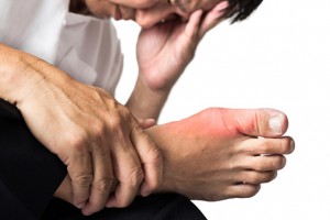 gout and osteoarthritis