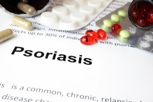 psoriasis