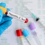 Hepatitis C infection