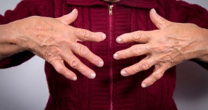 Rheumatoid arthritis raises risk of broken bones in young women
