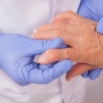 Senior woman with Rheumatoid arthritis visit a doctor