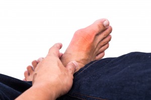 Gout treatment