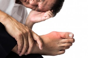 Gout may increase type 2 diabetes risk, women more vulnerable then men