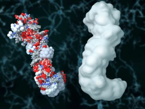 Amyloidosis (excess amyloid protein) can increase kidney failure, heart failure risk