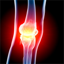 wood implants for joint health