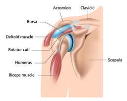 Bursitis.jpg