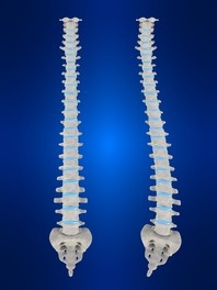 Scoliosis.JPG