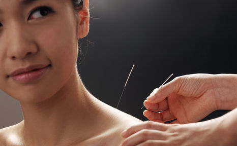 Can Acupuncture Help Ease Your Arthritis Pain?