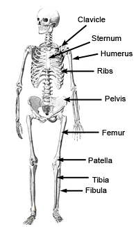 Pagets disease